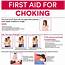 8 Best Images Of First Aid Choking Poster Printable 