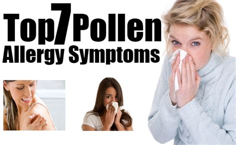 Top 7 Pollen Allergy Symptoms Natural Home Remedies And Supplements