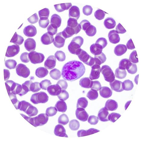 Monocyte Histology And Histophathology