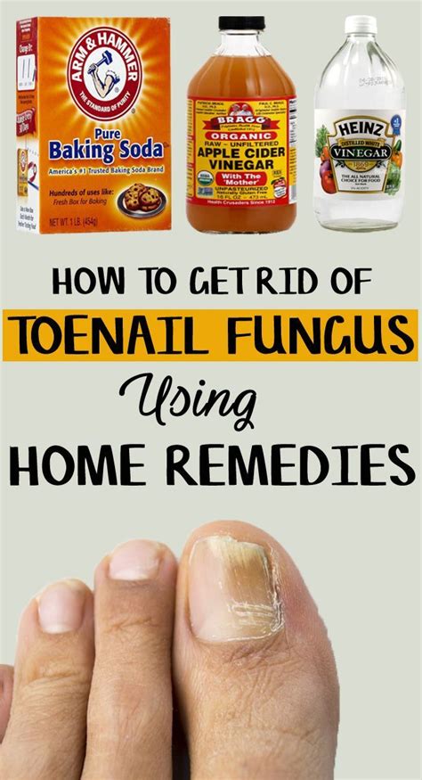 How To Get Rid Of Toenail Fungus 9 Home Remedies Included Toenail