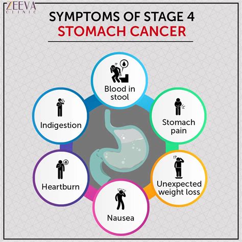 Stage 4 Stomach Cancer What Is Advanced Cancer By Zeeva Clinic Medium