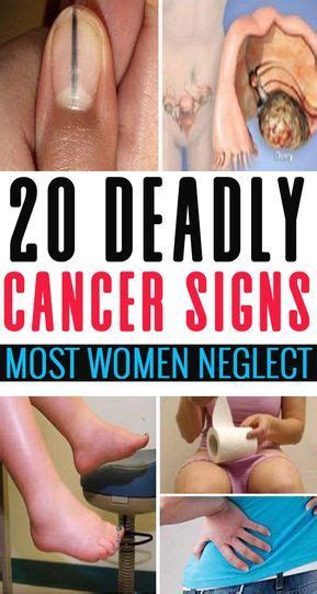 20 Deadly Cancer Symptoms Most Women Ignore Wellness Magazine