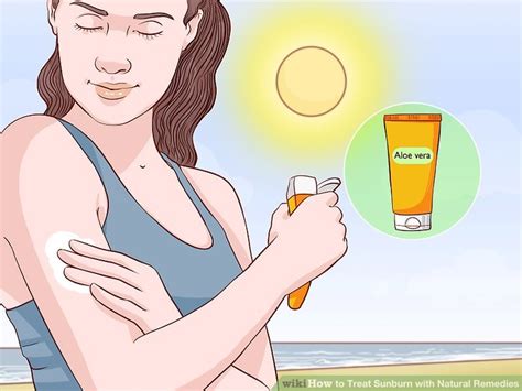 3 Ways To Treat Sunburn With Natural Remedies Wikihow