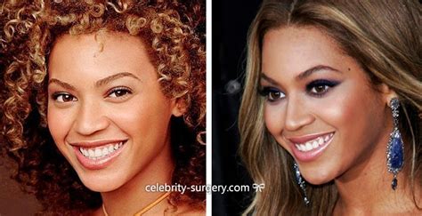 Beyonce Plastic Surgery Before After Nose Job Breast Implants