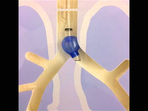 Double Lumen Endotracheal Tubes Tube Youtube Doubles Anesthesia