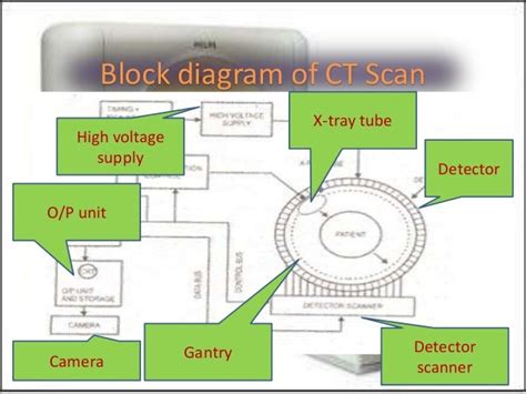 Scanning Systems Ct Scan