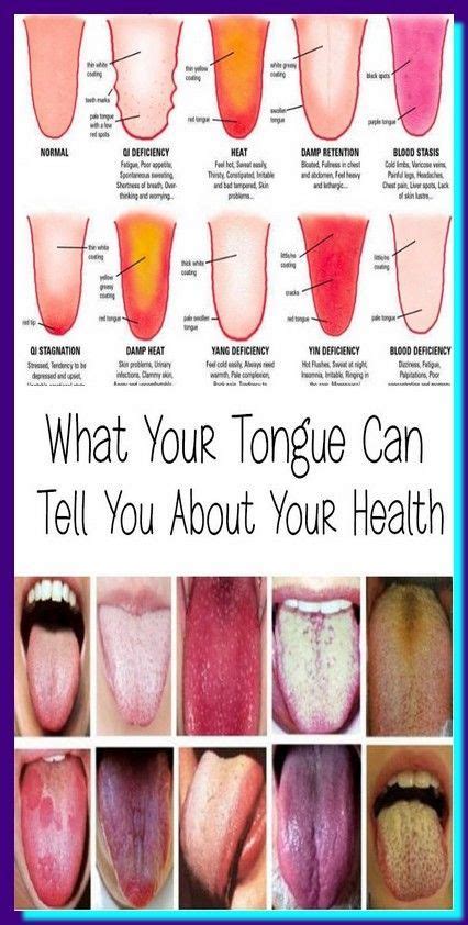 Tips For Nail And Tongue Health Tips Healthy Natural Magazine