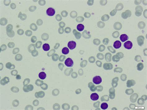 Blood Smear Histology Slides
