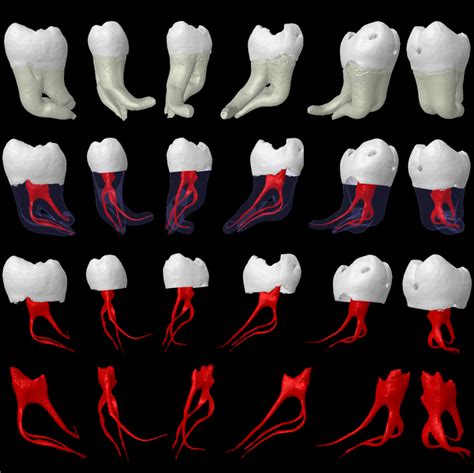 Dental School Pulp And Root Morphologies