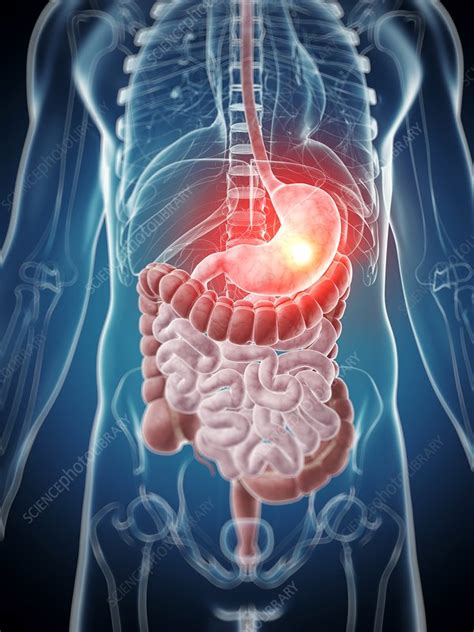Human Stomach Pain Illustration Stock Image F0107692 Science