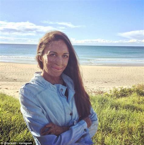 Bushfire Survivor Turia Pitt Gushes About Michael Hoskin Daily Mail Online