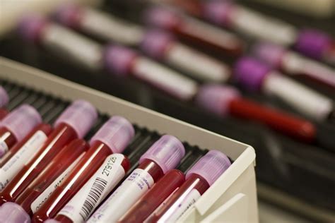 Why British Mps Are Urging Doctors To Conduct More Blood Cancer Tests