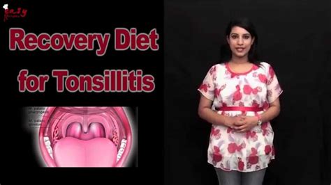 Recovery Diet For Tonsillitis Top 10 Tips Easy Recipes Youtube