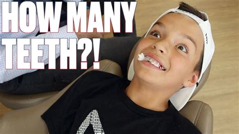 Nine Year Old Sets Record For Most Teeth Pulled In A Single Orthodontist Visit Losing Teeth