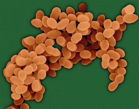 Staphylococcus Aureus Photograph By Dennis Kunkel Microscopyscience