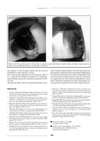 Management Of Nasal Septa