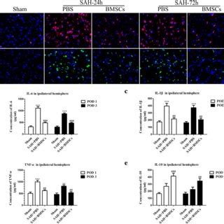 Effects Of Notch1 SiRNA On The Microglial Activation Inflammatory