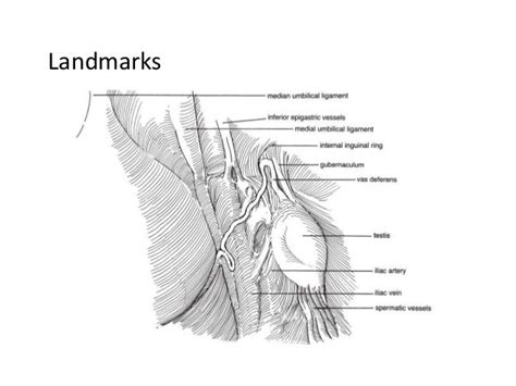 Development Of Testis And Cryptorchidism Presentation