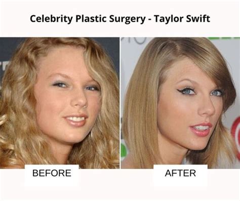Taylor Swift Weight Gain Or Plastic Surgery Templateascse