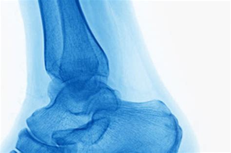 Boston Sports The Role Of Regenerative Medicine In Orthopedics