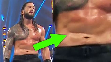 What S Wrong With Roman Reigns Stomach 5 Shocking Things WWE