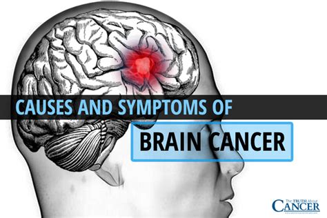 Causes And Symptoms Of Brain Cancer