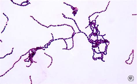 Gram Positive Cocci In Chains Gram Positive Cocci In Chains