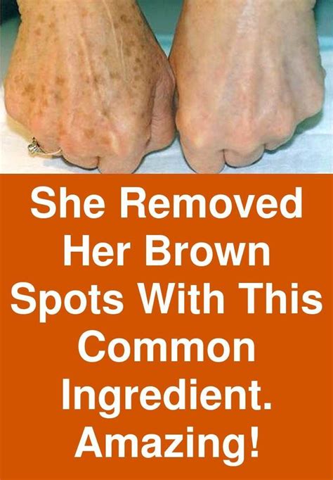 She Removed Her Brown Spots With This Common Ingredient Amazing Age
