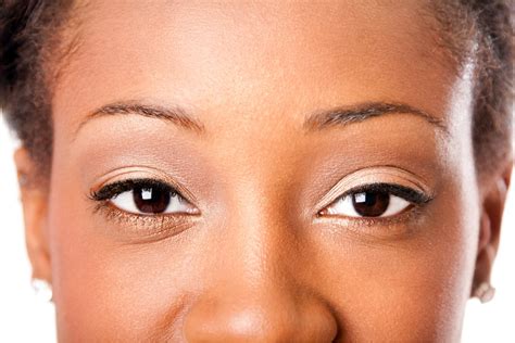 Canthoplasty Surgery For Larger Almond Eyes