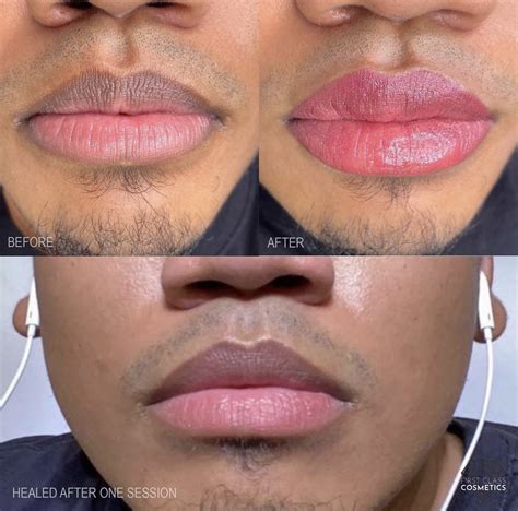 Discover 88 About Lip Tattoo Before And After Super Cool In Daotaonec