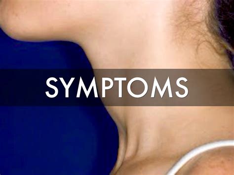 Head and neck cancers are often curable when caught in the early stages. Thyroid Cancer Symptoms