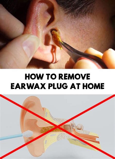 How To Remove Earwax Plug At Home Ear Wax Dry Skin Routine Hearing Problems