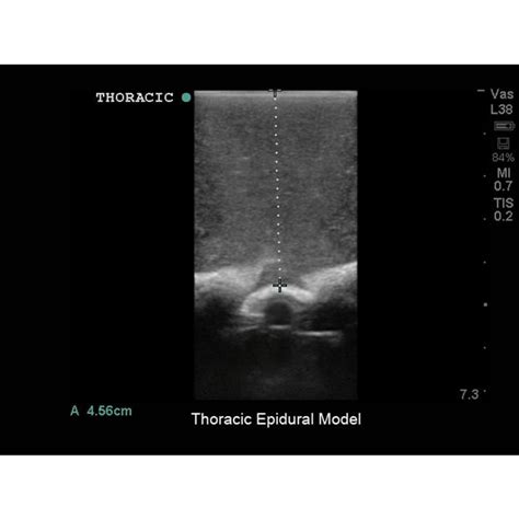 Lumbar Puncture And Spinal Epidural Ultrasound Training Modellp