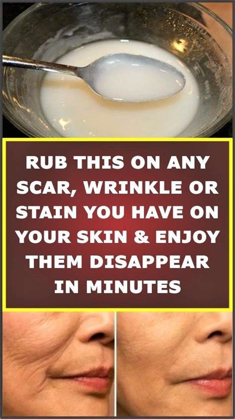 Rub This Remedy On Any Scar Wrinkle Or Stain You Have On Your Skin And