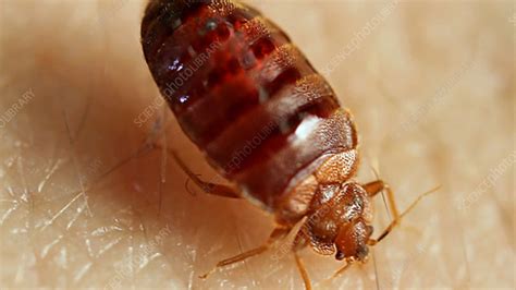Bed Bug Feeding On A Human Stock Video Clip K0035261 Science