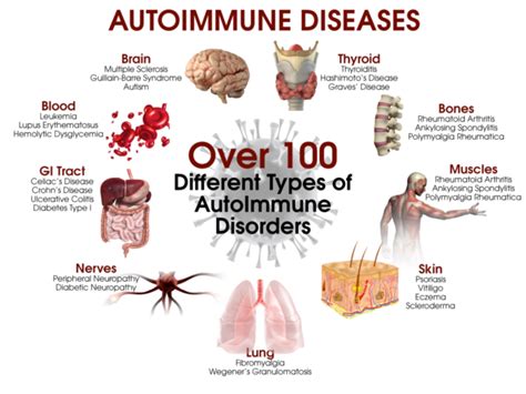 Link Between A Number Of Autoimmune Diseases And An Increased Risk Of
