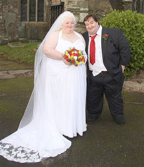 Steve Beer And Wife Who Were Too Fat To Work Lose Stone Daily