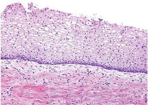 Normal Uterine Cervix Abdominal Key