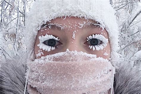 Blistering Cold Temps In Russia Are Freezing Peoples Eyelashes