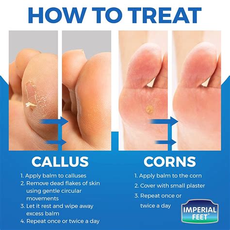 Foot Callus Remover For Feet Extra Strenght With Salicylic Acid Corn Removers For Feet And