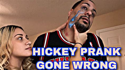 Hickey Prank Gone Wrong Pranks Youtube Pranks Gone Wrong
