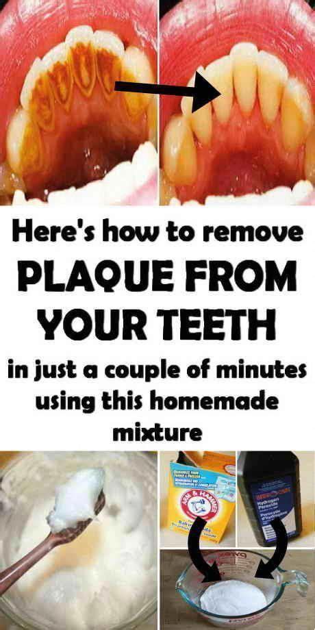 Remove Plaque From Your Teeth With This Homemade Mixture In 2020