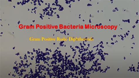 Gram Positive Bacteria In Gram Stain Gram Positive Rods Or Bacilli