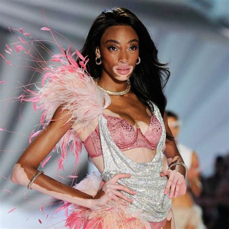 Winnie Harlow Shares How Much She Weighed For The Vs