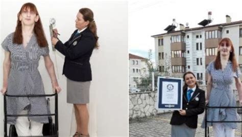 Meet 24 Year Old Rumeysa Gelgi From Turkey The Worlds Tallest Woman