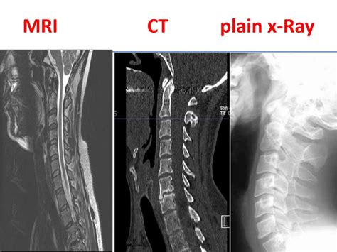 Difference Between An Mri Ct And X Ray Scan Omega Pds