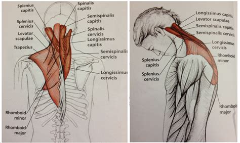 From the sides and the back of the neck, the splenius capitis inserts onto the head region, and the splenius. Here you will be focusing the stretch on the Longissimus muscles, the Semispin… | Neck and ...