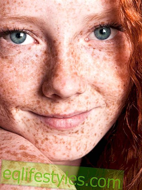 10 Things That Only Women With Freckles Know Life