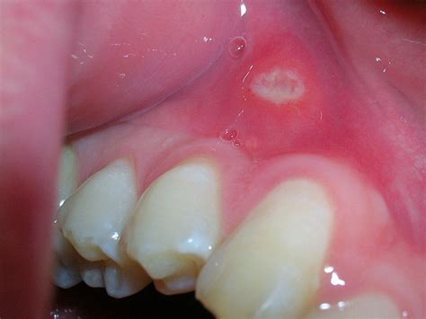 Pin On Dental Health