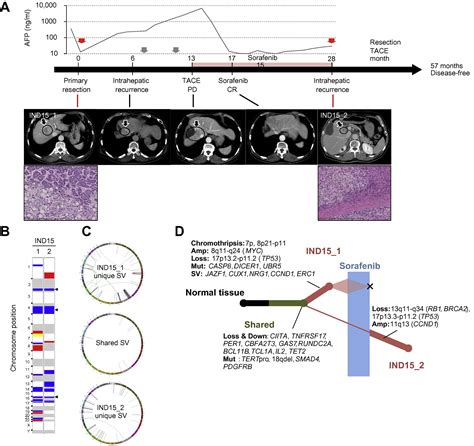 Whole Genome Sequencing Discriminates Hepatocellular Carcinoma With